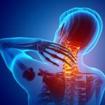 Neck-Pain-medical-marijuana
